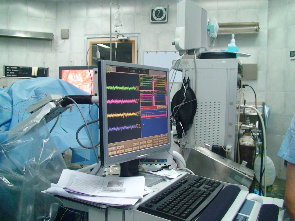 Intraoperative Neurophysiological Monitoring