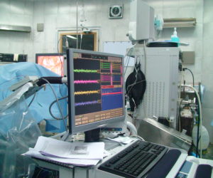 Intraoperative neurophysiological monitoring for Cervical rhizotomy