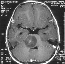 MRI for Stereotactic Procedures