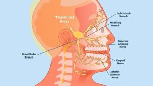 Diagnosis of Trigeminal Neuralgia