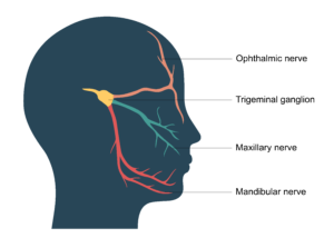 Symptoms of Trigeminal Neuralgia