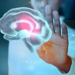 Shining a Light on Deep Brain Stimulation A Breakthrough Treatment for Dystonia