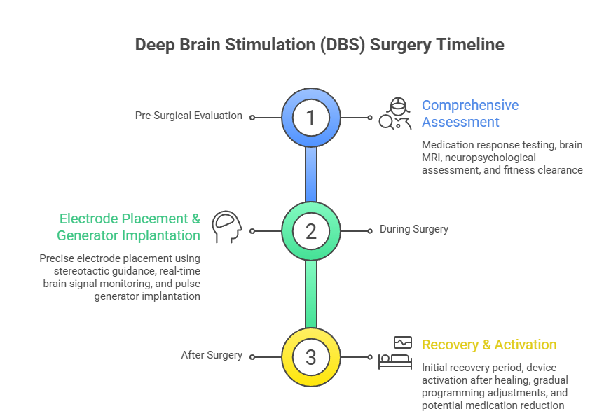 dbs surgery process